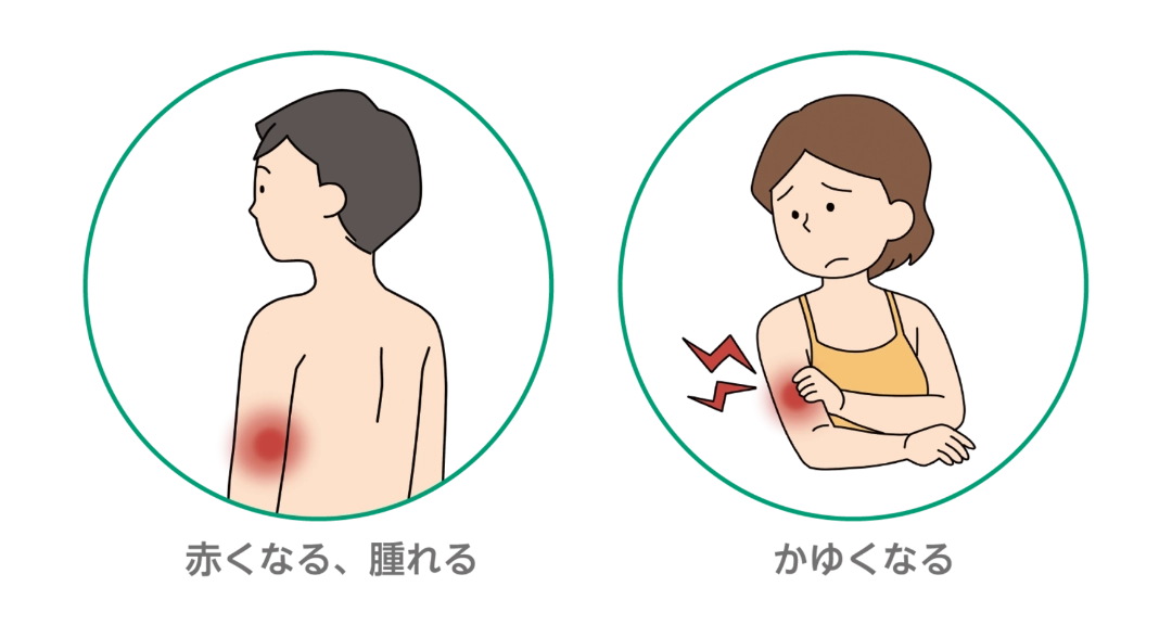 赤くなる、腫れる　かゆくなる