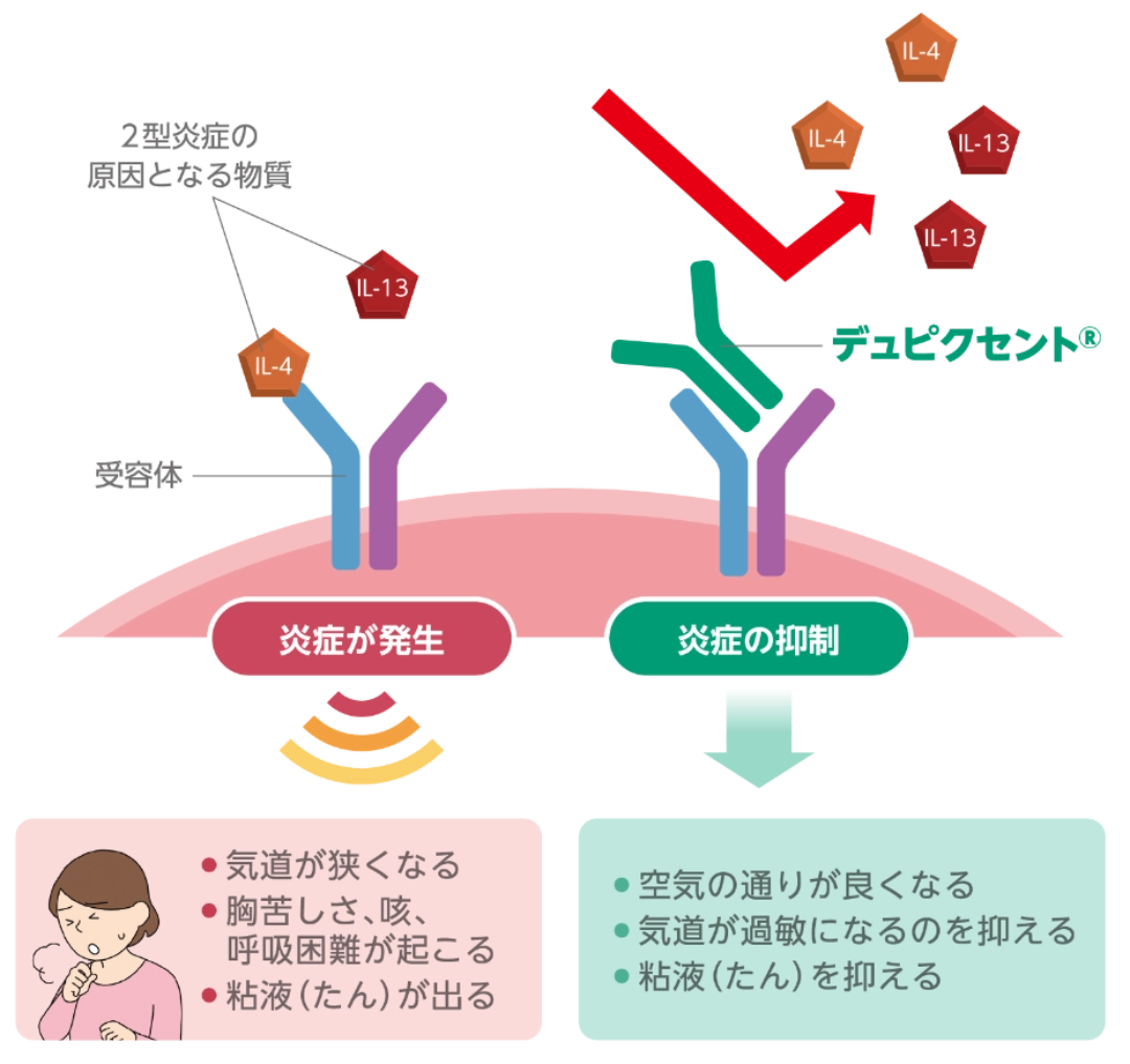 デュピクセントのはたらき（イメージ図）