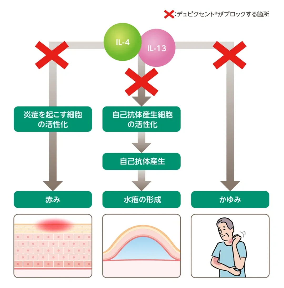 デュピクセントの作用