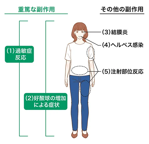 重大な副作用として重篤な過敏性と急性汎発性発疹性膿疱症、好酸球増加症による症状があり、その他の副作用として結膜炎やヘルペス感染、注射部位反応があります