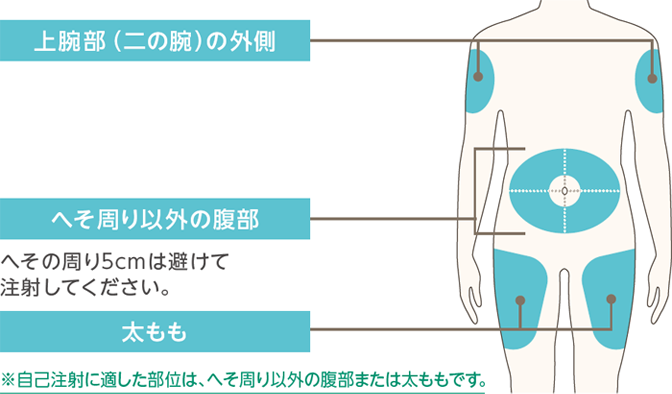 図2. うで（上腕部）、お腹、太ももなどに注射します