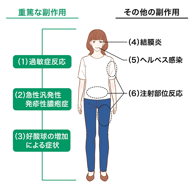 重大な副作用として重篤な過敏性と急性汎発性発疹性膿疱症、好酸球増加症による症状があり、その他の副作用として結膜炎やヘルペス感染、注射部位反応があります