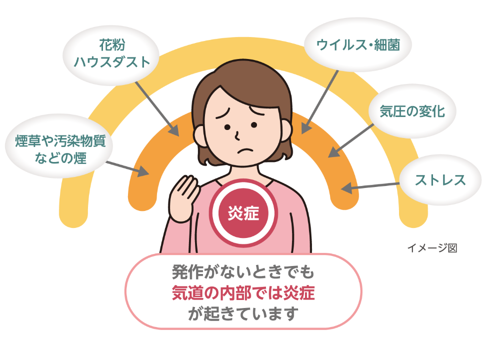 ウイルスや細菌、気圧の変化やストレス等により、発作がないときでも気道の内部では炎症が起きています