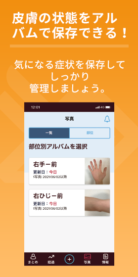 皮膚の状態をアルバムで保存できる！気になる症状を保存してしっかり管理しましょう。