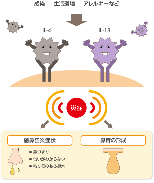 図1. 慢性副鼻腔炎で起きていること